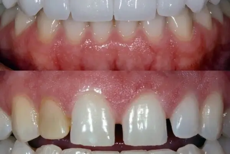 1732113619.441679_259638_image