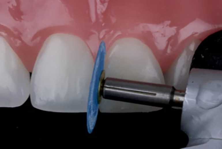 1732113651.320661_221691_image