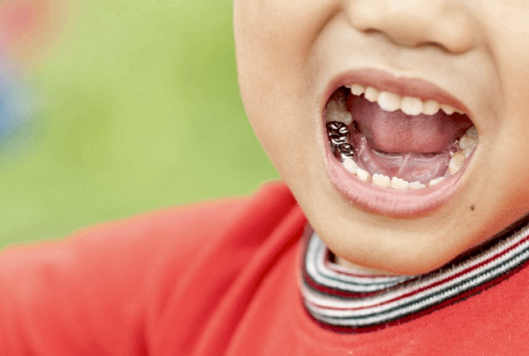 1732113671.852114_480697_image