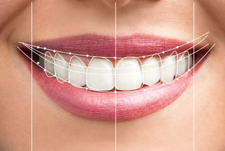 1732113692.583581_627643_image