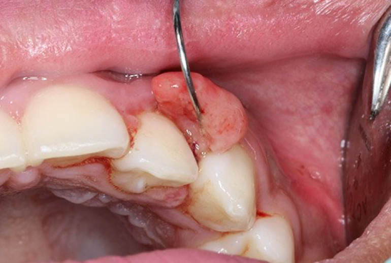 1732113702.826361_367431_image